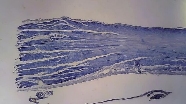 Microscope Human Skeletal Muscle 800x