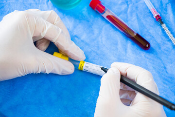 Doctor in laboratory with uniform write text on the blood tube sample