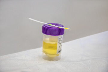 urine sample