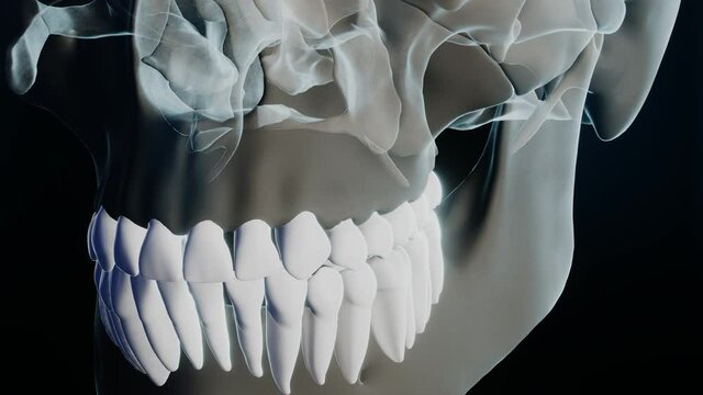 Bad molar tooth in skeleton on black background. 3D render concept animation of dentistry stomatology treatment toothache surgery cavity protection recovery