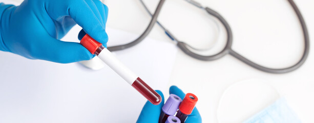 Coronavirus 2019-nCoV Blood Sample.