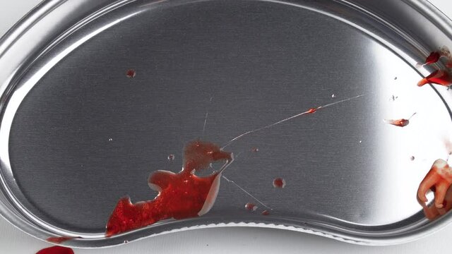 Shooting of a bloodied wisdom tooth in a kidney-shaped tray