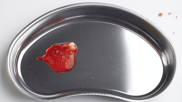 Shooting of a bloodied wisdom tooth in a kidney tray