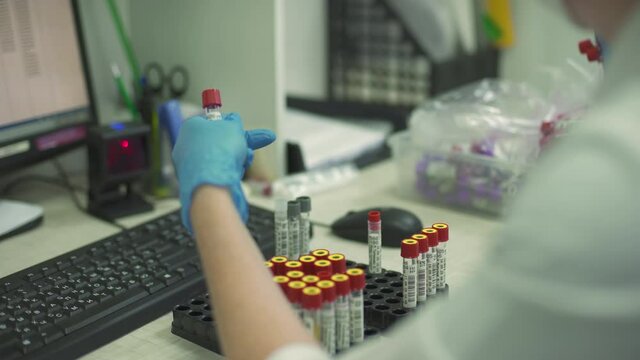 doctor scans test tubes with tests