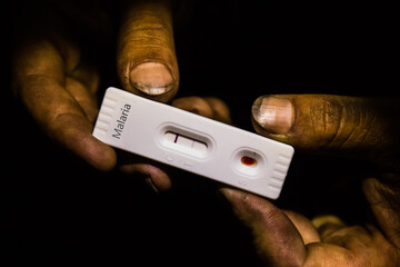 Dirty hands holding a positive malaria test in the dark - obrazy, fototapety, plakaty
