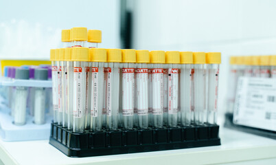 The test tubes in the laboratory are prepared for taking blood for coronavirus infection. COVID-19