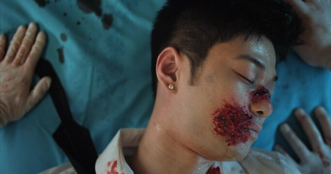 Close up of paramedic checking heart beat to young man with wounds and blood on head.Top view of asian guy with injuries losing consciousness while lying on hospital stretcher
