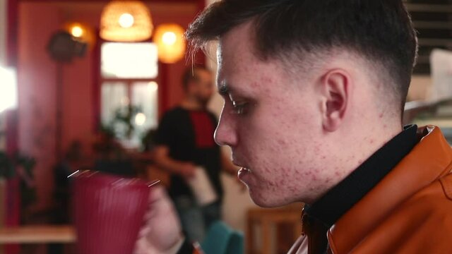A man on a date doesn't get complex about facial skin problems. Chin and jawline acne is often caused by fluctuations in hormones, which means a disruption with endocrine system.