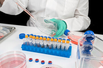 Scientist working on sars-cov-2 coronavirus covid-19 on a petri dish in the laboratory, conceptual...