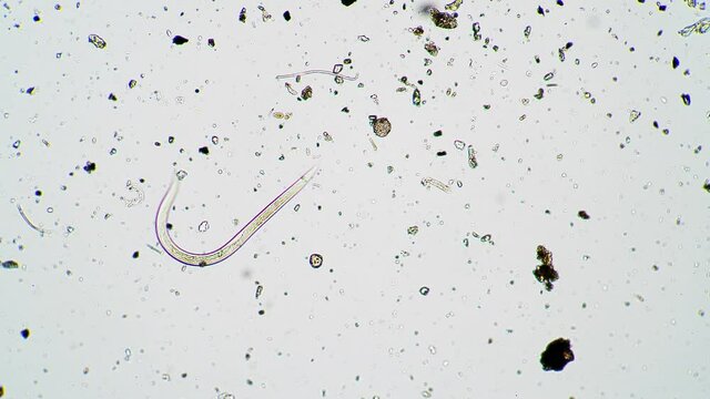 The small nematode is wiggling in the moss water with algae under microscope. The worm is moving in it's own path in it's life environment. Theme of small creatures in microcosmos.