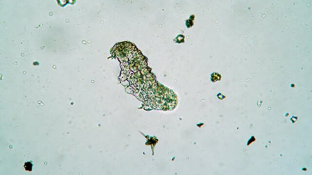 Tiny moss piglet is moving paws rapidly trying to turn over under microscope. The tardigrade is laying on it's back and wants to stand. Theme of the microscopic animals and their life environment.