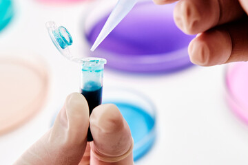 Scientist uses a pipette for collection a media from eppendorf tube and transfer it to Petri dish for microchemical analysis in the research laboratory