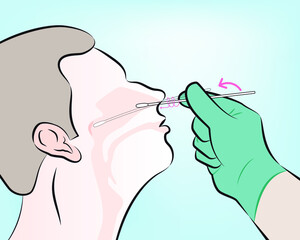 step 4 : Gently insert the swab into the nostril. Keep the swab near the septum floor of the nose while gently pushing the swab into the post nasopharynx.