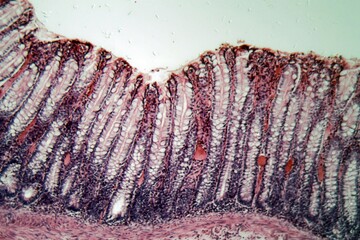 Microscope photo of rectum cells of a dog.