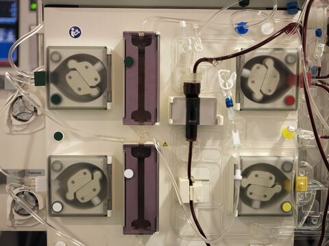 Dialysis machine