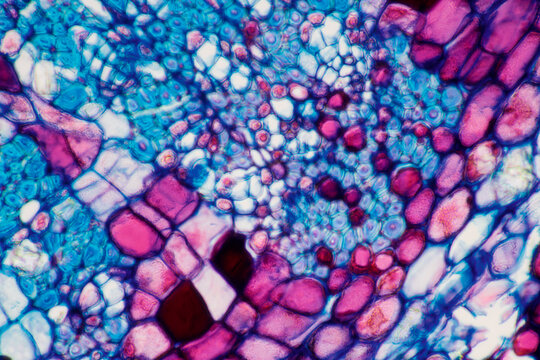 Micrograph Plant Cells Of Woody Dicot Stem