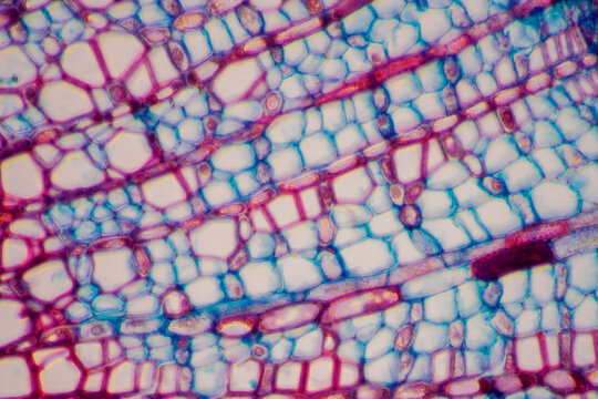 micrograph plant cells of woody dicot stem
