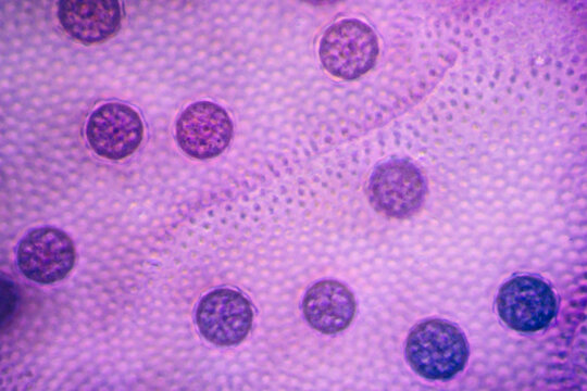 pond life volox micrograph
