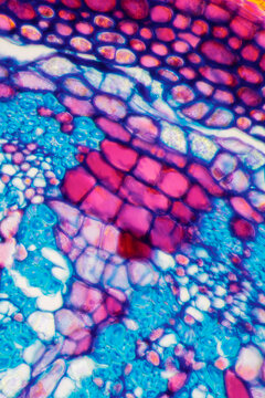 micrograph plant cells of woody dicot stem