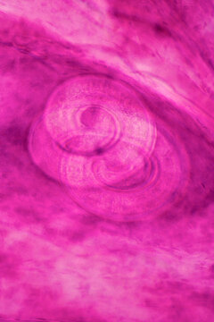 parasite Trichinella spiralis w.m