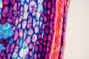 micrograph plant cells of woody dicot stem