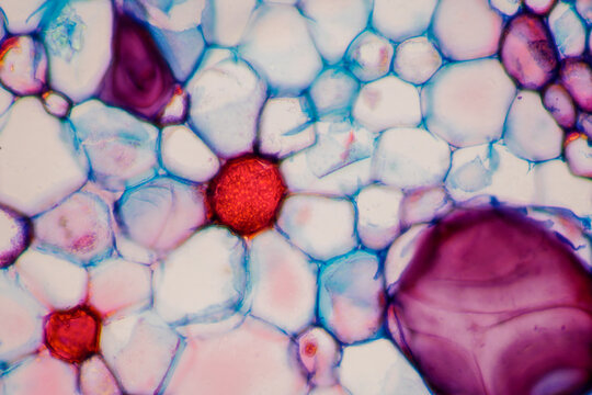 micrograph plant cells of woody dicot stem