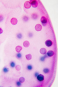 pond life volox micrograph