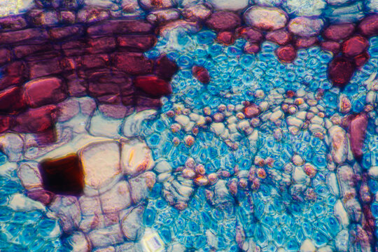 micrograph plant cells of woody dicot stem
