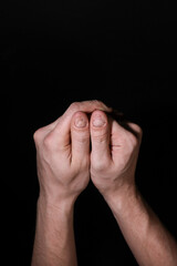 Man hand nail damage. Bitten nails. nail care. Men manicure. Nail plate problems. Man hands . Isolated on a black background.	