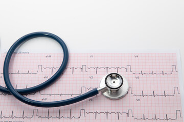Blue Stethoscope on electrocardiogram (ECG) chart paper. ECG heart chart scan isolate on white....