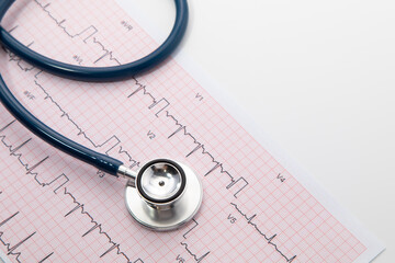 Blue Stethoscope on electrocardiogram (ECG) chart paper. ECG heart chart scan isolate on white....