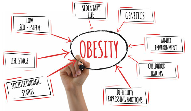 Diagram of causes of obesity on white background.