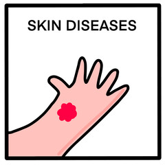 Skin disease hand drawn vector illustration in cartoon doodle style icon arm with spot red