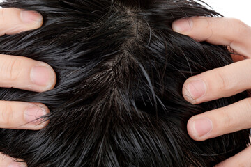 Obraz premium 頭皮