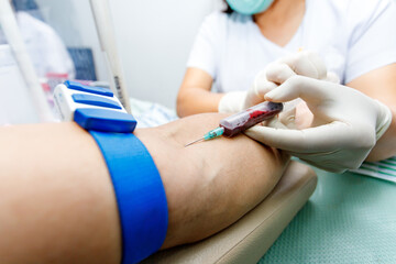 Fototapeta na wymiar nurse taking blood sample from patient's arm. Preparation of blood to procedure Plasmolifting.