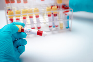 Test tubes containing blood and plasma extracted from the blood of people who had been ill with...
