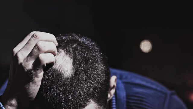 Balding caucasian man grabs head in angst over hair loss Close up shot