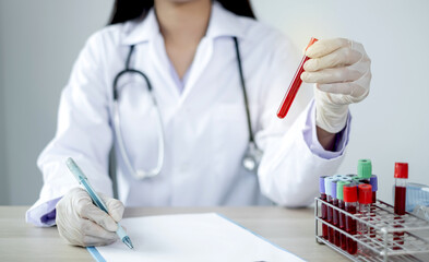 The picture of doctor's hand holding blood tube coronavirus test