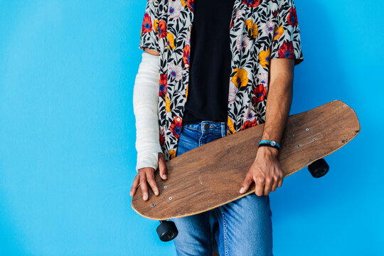 Man with fractured arm holding skateboard while standing against blue background
