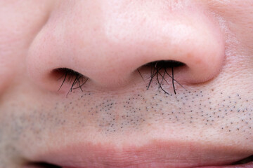 Young man's nose His nostrils are hairy. . Health and medical concepts