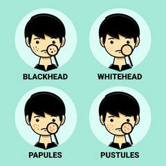 Boy with acne on face. Acne type. Facial beauty. Illustration vector
