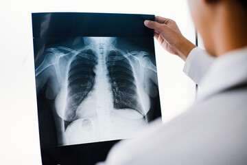 Radiology doctor examining at chest x ray film of patient at health care clinic