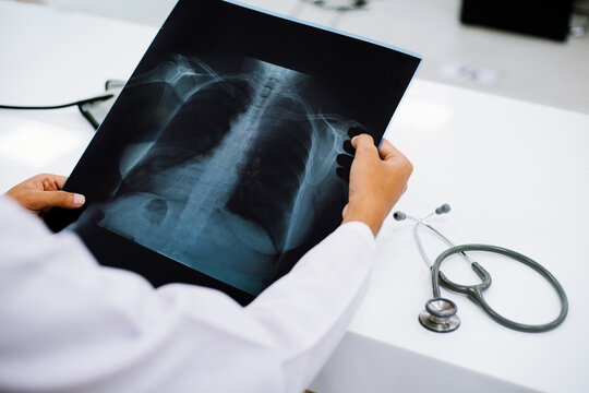 Radiology doctor examining at chest x ray film of patient at health care clinic