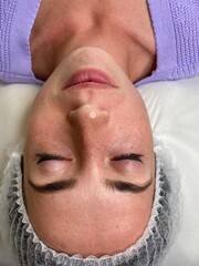 Fototapeta premium Cosmetology cabinet procedures. A young female face when lying at ultrasound cleaning. Dermatology. 