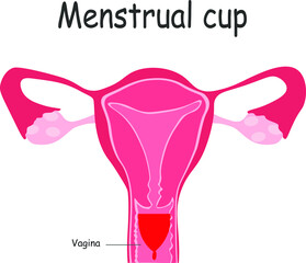 Menstrual cup. feminine hygiene product, a device for collecting blood during menstruation and period is used inside the vagina of woman female