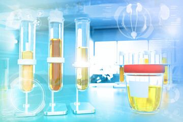 proofs in modern pharmaceutical study office - urine quality test for leukocyte esterase or cystine, medical 3D illustration