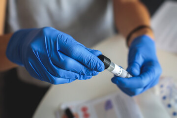 Process of coronavirus testing examination at home, COVID-19 swab collection kit, test tube for taking OP NP patient specimen sample, testing carried out, patient receiving a corona test