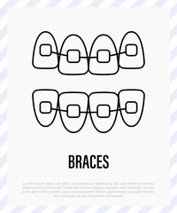 Orthodontics: braces, teeth correction. Dentistry. Thin line icon, vector illustration.