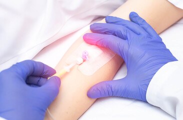 Doctor inserting an intravenous catheter for blood transfusion into a patient, close-up. Blood...