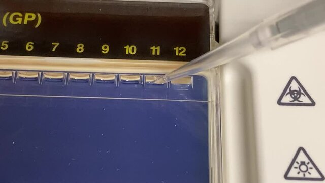 Biomolecular technician loading DNA sample on Agarose gel electrophresis. Close-up